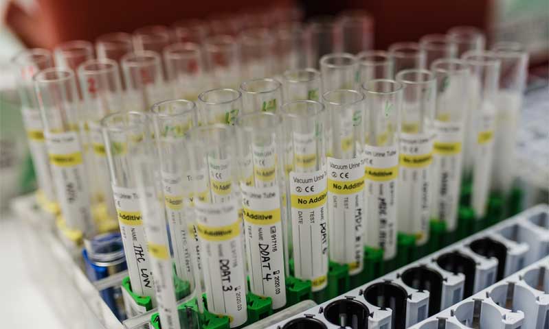 Lab test samples